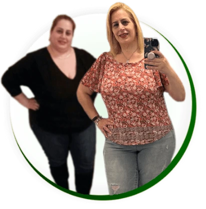 Jennifer Lost over 69 lbs after Sleeve Gastrectomy